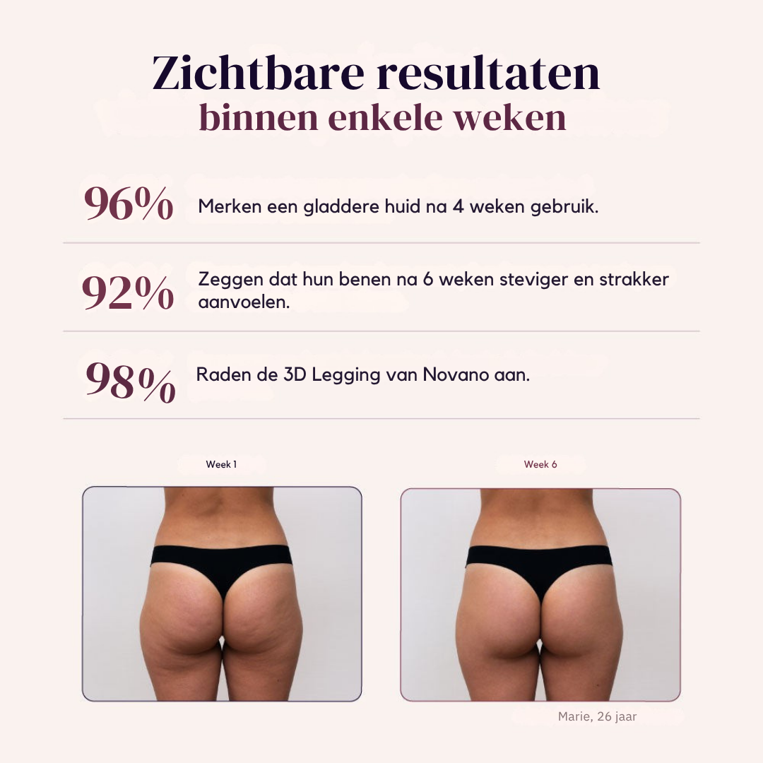 3D Anti-Cellulite Legging
