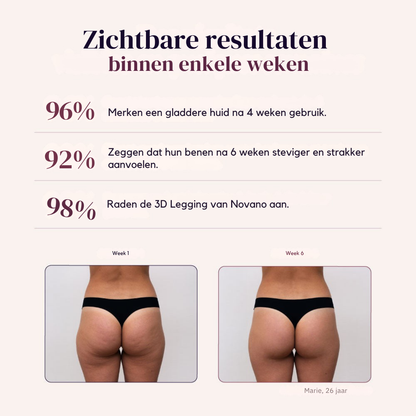 3D Anti-Cellulite Legging
